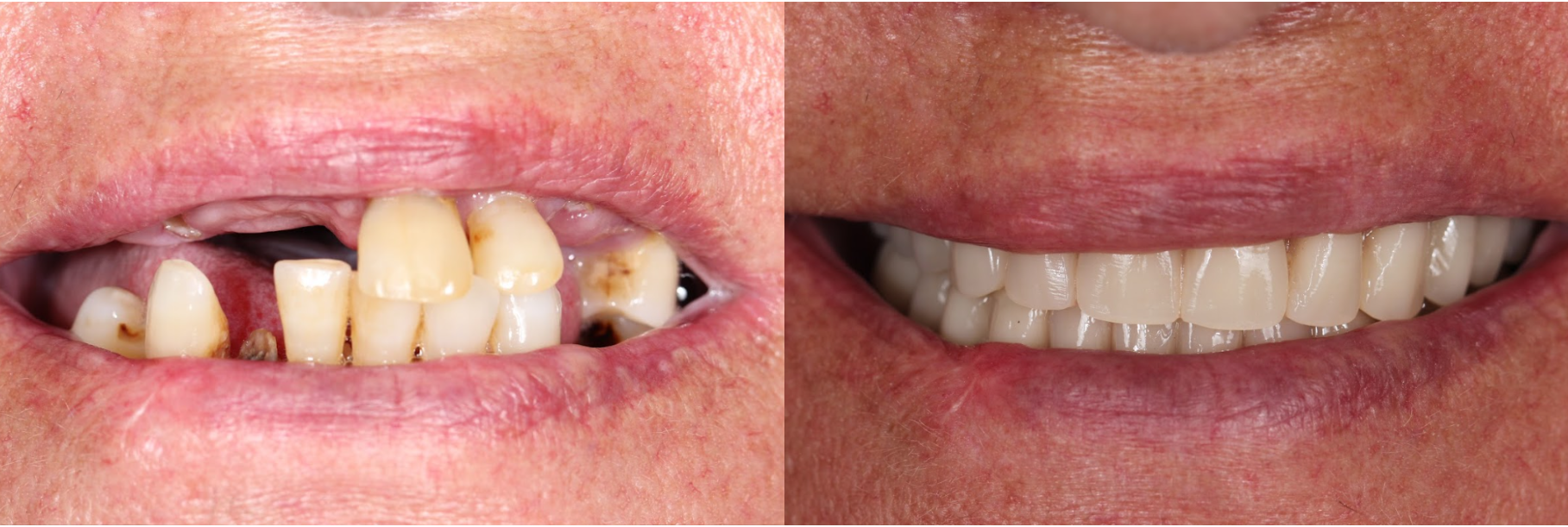 antes-depois3